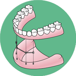 dentures-partials