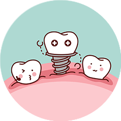 oral-surgery-implants